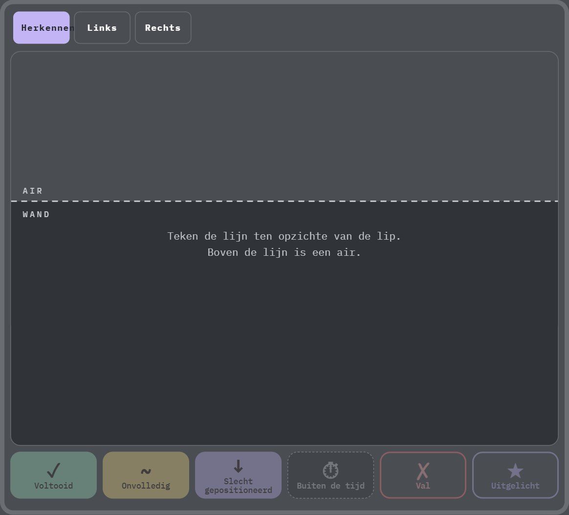 Surf-deck in de app, modus Gebaren